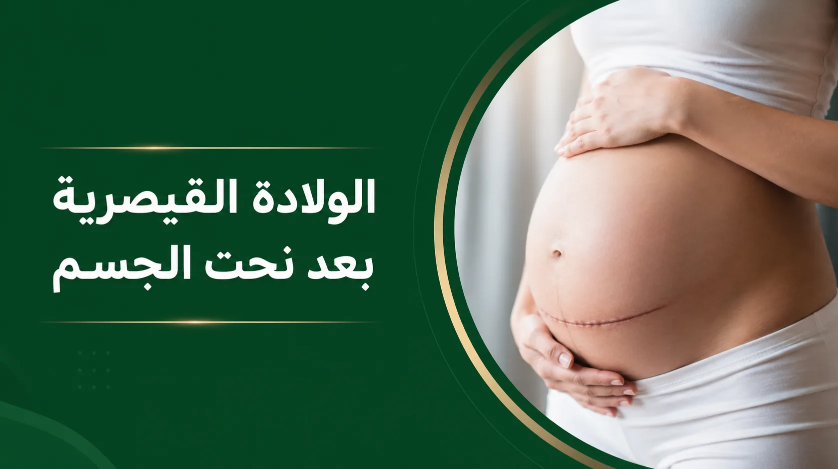الولادة القيصرية بعد نحت الجسم